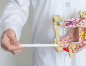 Kolon Kanseri 1 Kolon Kanseri