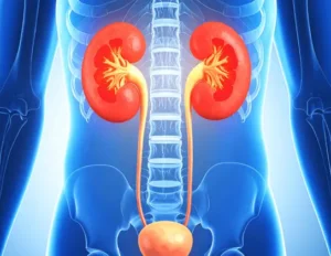 Mesane Kanseri 1 Mesane Kanseri